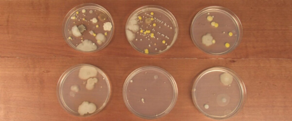 Growing Bacteria in Petri Dishes Science Project For 4th Grade